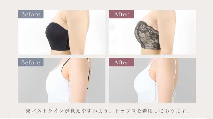 ツーハッチの2wayストラップレスダスティフルールブラ③